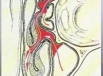 窦口鼻道复合体（解剖学术语）