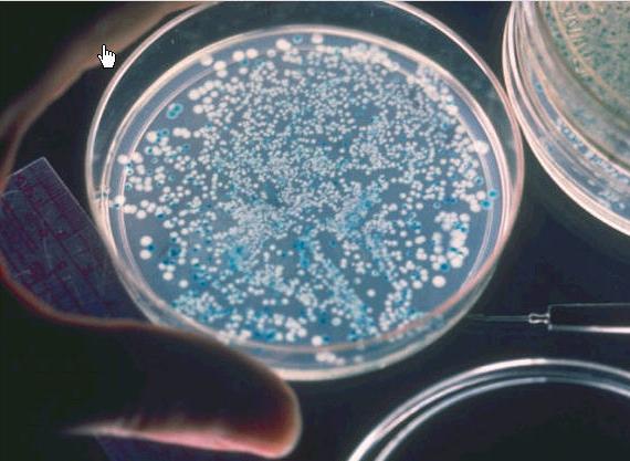 蓝白斑筛选（基因工程常用的重组菌筛选方法）